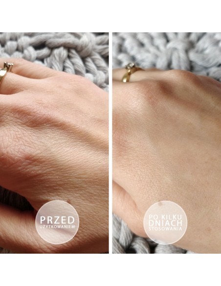 S.O.S - Intensywnie natłuszczająca maść z witaminą E 100ml