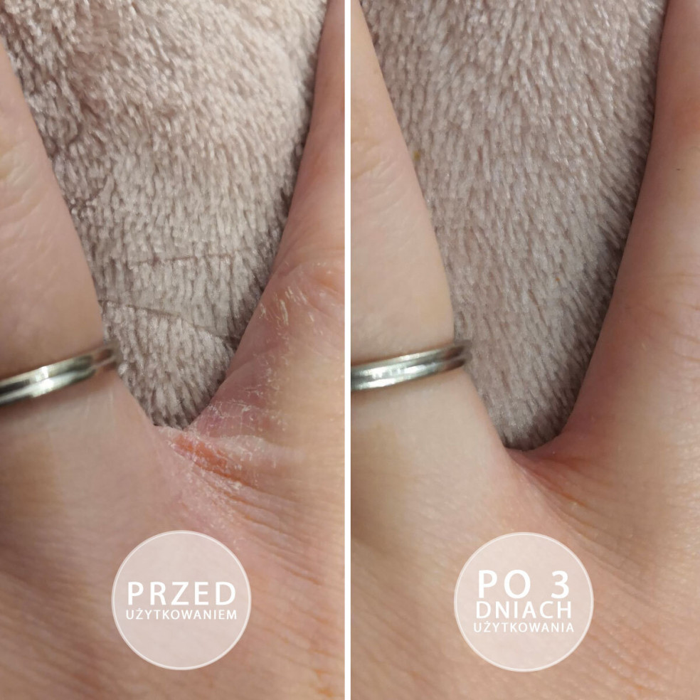 S.O.S - Intensely moisturizing... S.O.S - Intensely moisturizing...
