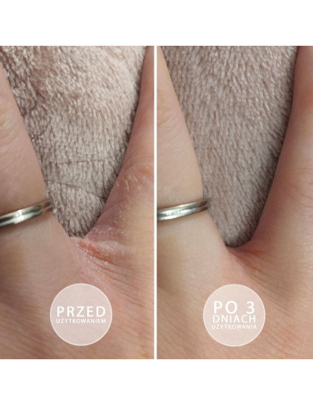 S.O.S - Intensywnie natłuszczająca maść z witaminą E 100ml