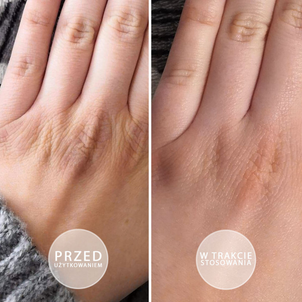 S.O.S - Intensywnie natłuszczająca...