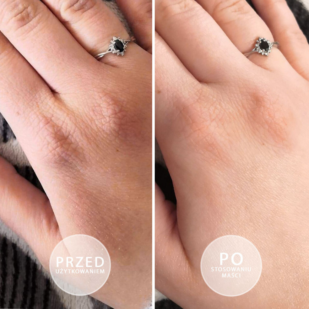 S.O.S - Intensywnie natłuszczająca...