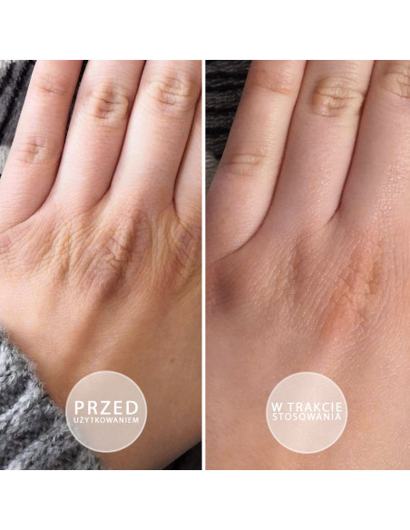 Kobieca dłoń prezentująca efekty przed i po sotosowaniu natłuszczającej maści do rąk