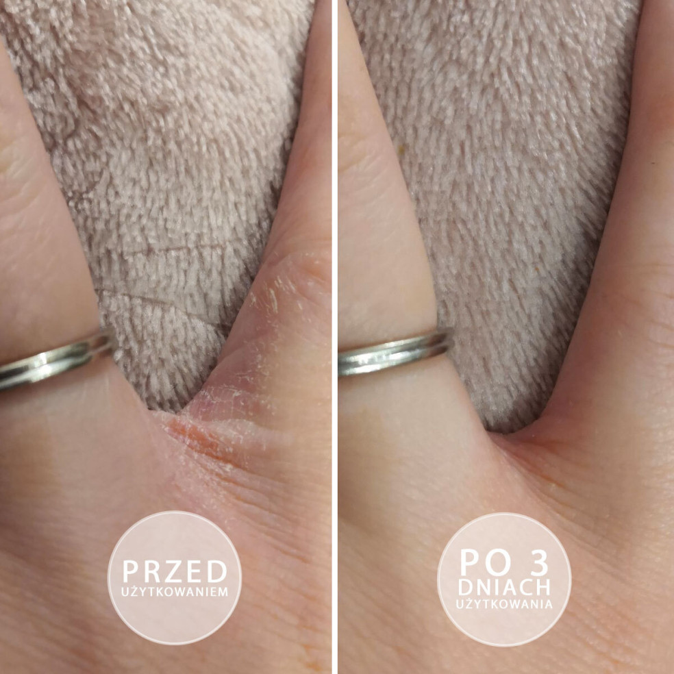 S.O.S - Intensely moisturizing...