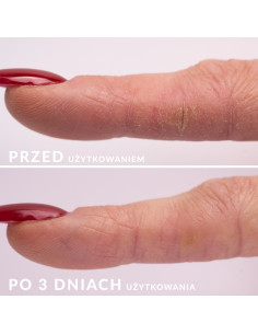 S.O.S. - Regenerating serum... 2