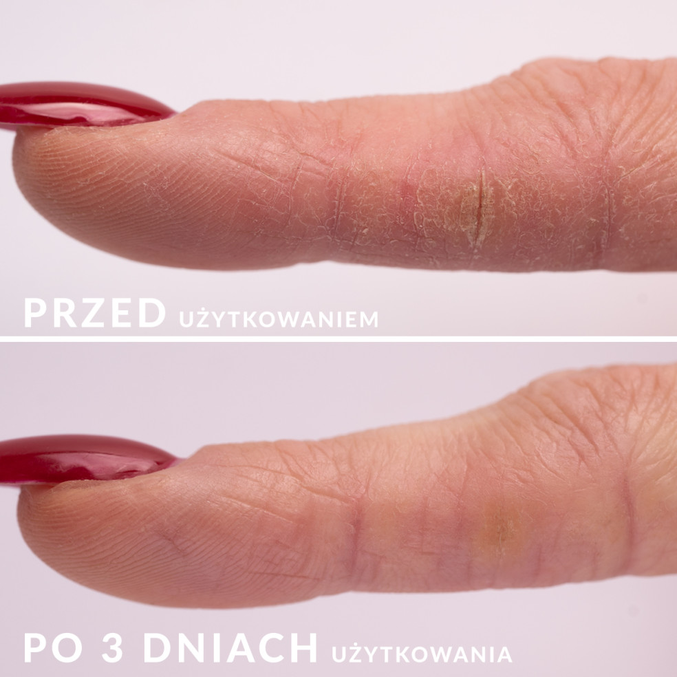 S.O.S. - Regenerating serum for skin...