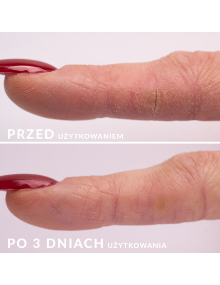 S.O.S. - Regenerating serum for skin and nails 10 ml