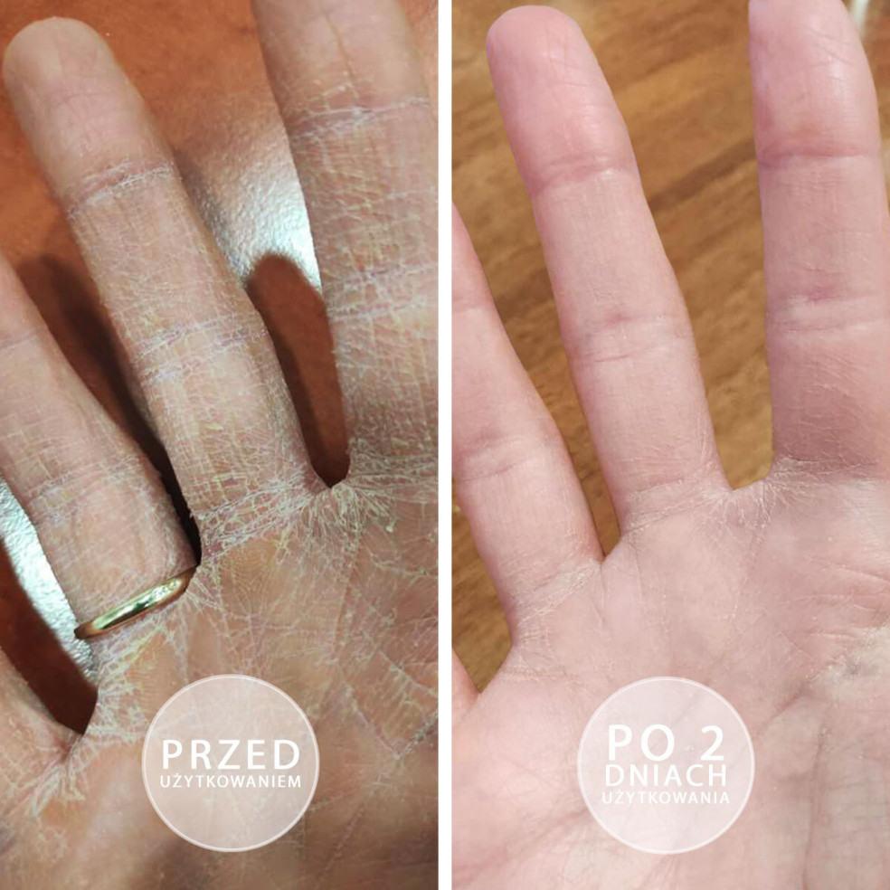 Próbka maści S.O.S - Intensywnie natłuszczająca maść z witaminą E - saszetka 3g BEAUTICA - 4