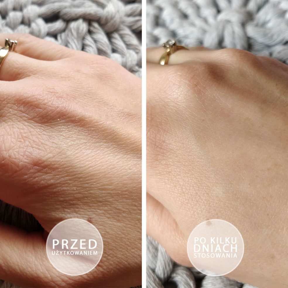 Próbka maści S.O.S - Intensywnie natłuszczająca maść z perłową poświatą - saszetka 3g BEAUTICA - 5